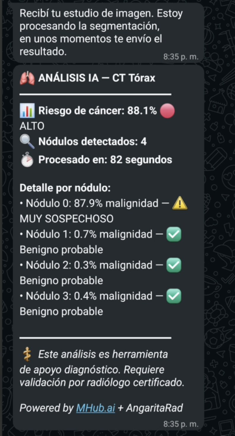 Resumen del análisis de IA recibido en WhatsApp: riesgo 88,1 %, cuatro nódulos, detalle por nódulo